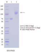 ACE2 Antigen